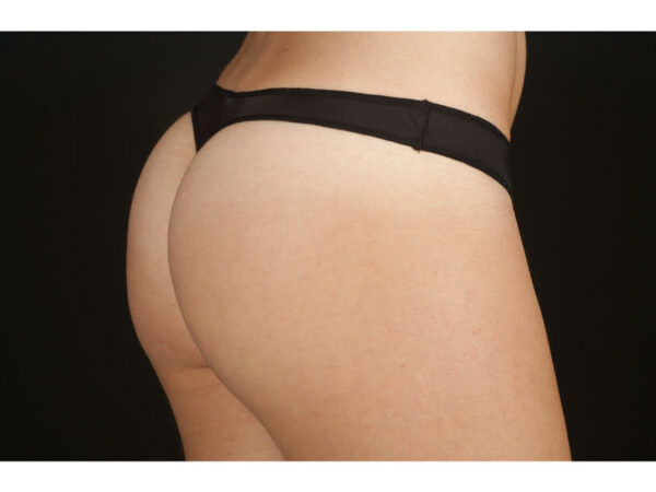 TANGA 800 SELENE - Imagen 3