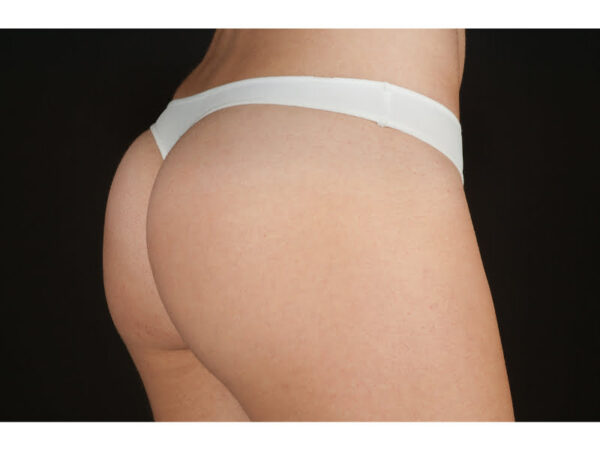 TANGA 800 SELENE - Imagen 2